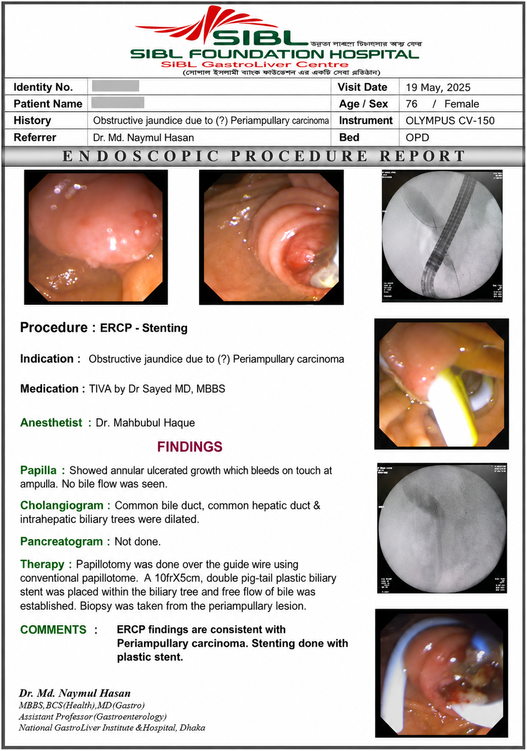 ERCP procedure-এর ক্লিনিক্যাল চিত্র