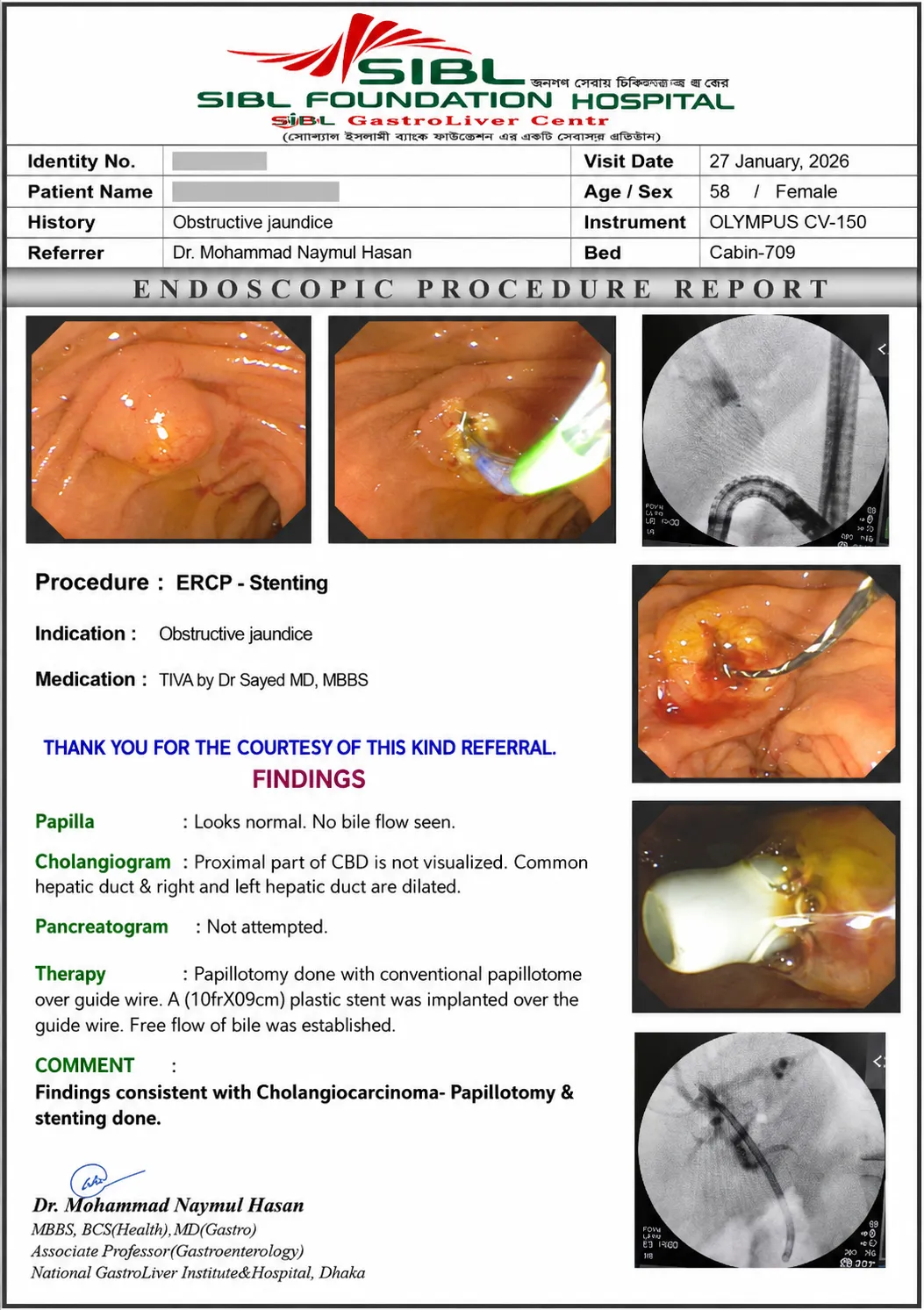 ERCP চলাকালীন endoscopic view